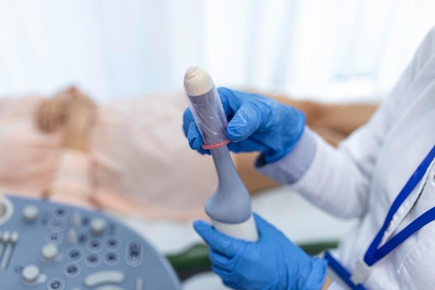 Proses Pengambilan Sel Telur Saat IVF, Ovum Pick-Up (OPU)